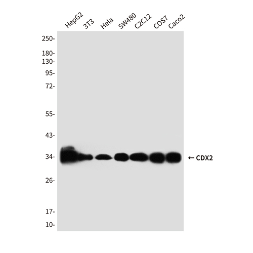 CDX2 (4B9)鼠单抗,CDX2 (4B9) Mouse Monoclonal Antibody