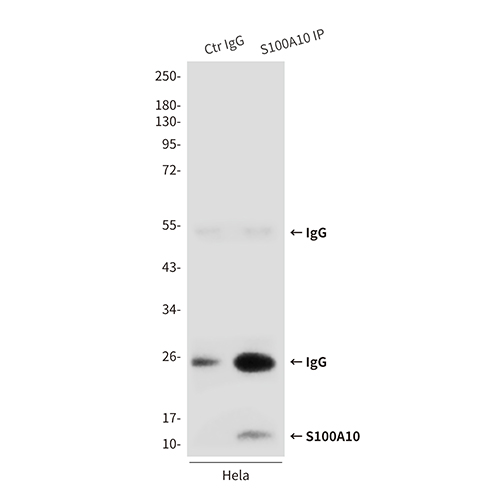 S100A10 (6F4)鼠单抗,S100A10 (6F4) Mouse Monoclonal Antibody
