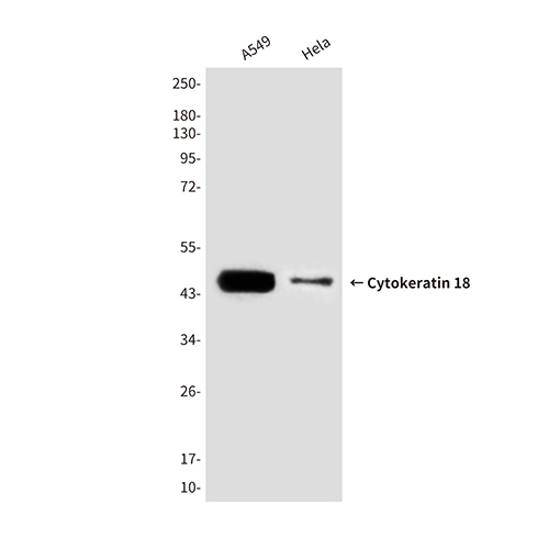 Cytokeratin 18 (6A8)鼠单抗,Cytokeratin 18 (6A8) Mouse Monoclonal Antibody