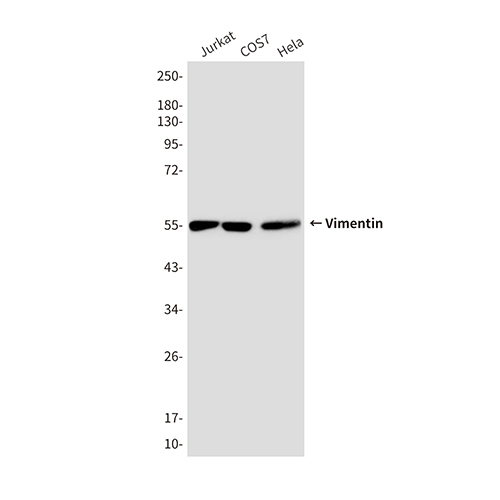 Vimentin (10E2)鼠单抗,Vimentin (10E2) Mouse Monoclonal Antibody