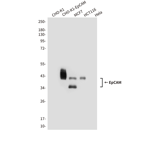 EpCAM (1D5)鼠单抗,EpCAM (1D5) Mouse Monoclonal Antibody