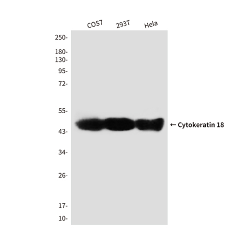 Cytokeratin 18 (2B5)鼠单抗,Cytokeratin 18 (2B5) Mouse Monoclonal Antibody