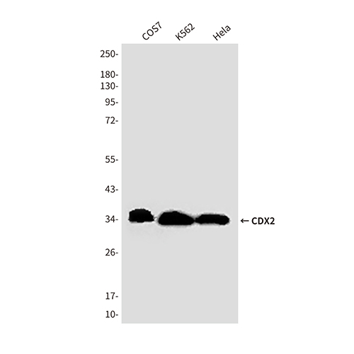CDX2 (4F12)鼠单抗,CDX2 (4F12) Mouse Monoclonal Antibody
