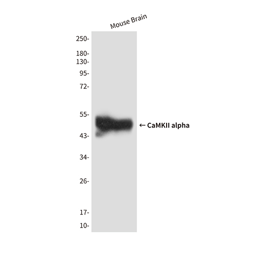 CaMKII alpha (5D9)鼠单抗,CaMKII alpha (5D9) Mouse Monoclonal Antibody