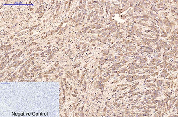 AFP alpha 1 Fetoprotein(17C5)鼠单抗,AFP alpha 1 Fetoprotein(17C5)Mouse Monoclonal Antibody