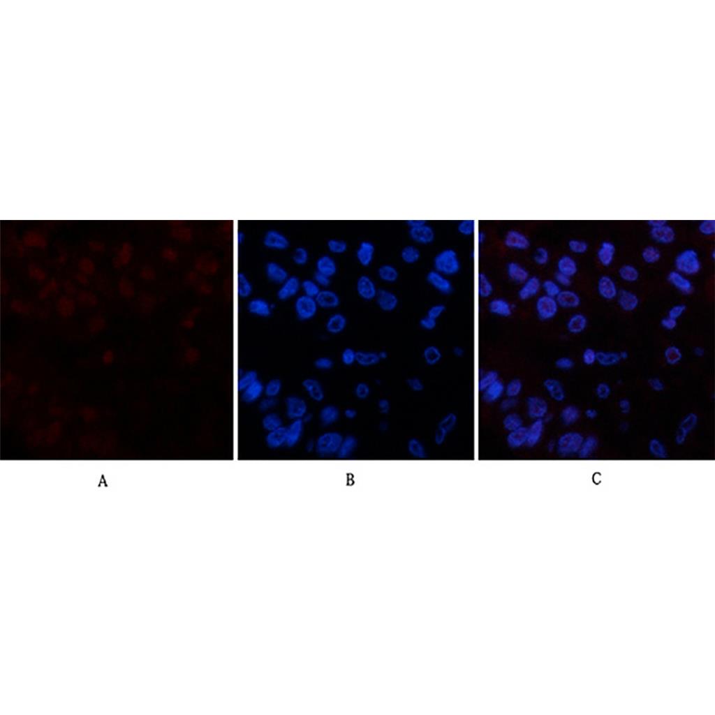 Cleaved PARP(Mix)鼠单抗,Cleaved PARP(Mix)Mouse Monoclonal Antibody