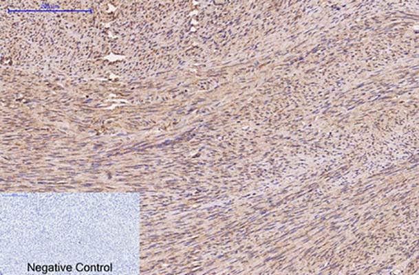 FH(7F1)鼠单抗,FH(7F1)Mouse Monoclonal Antibody