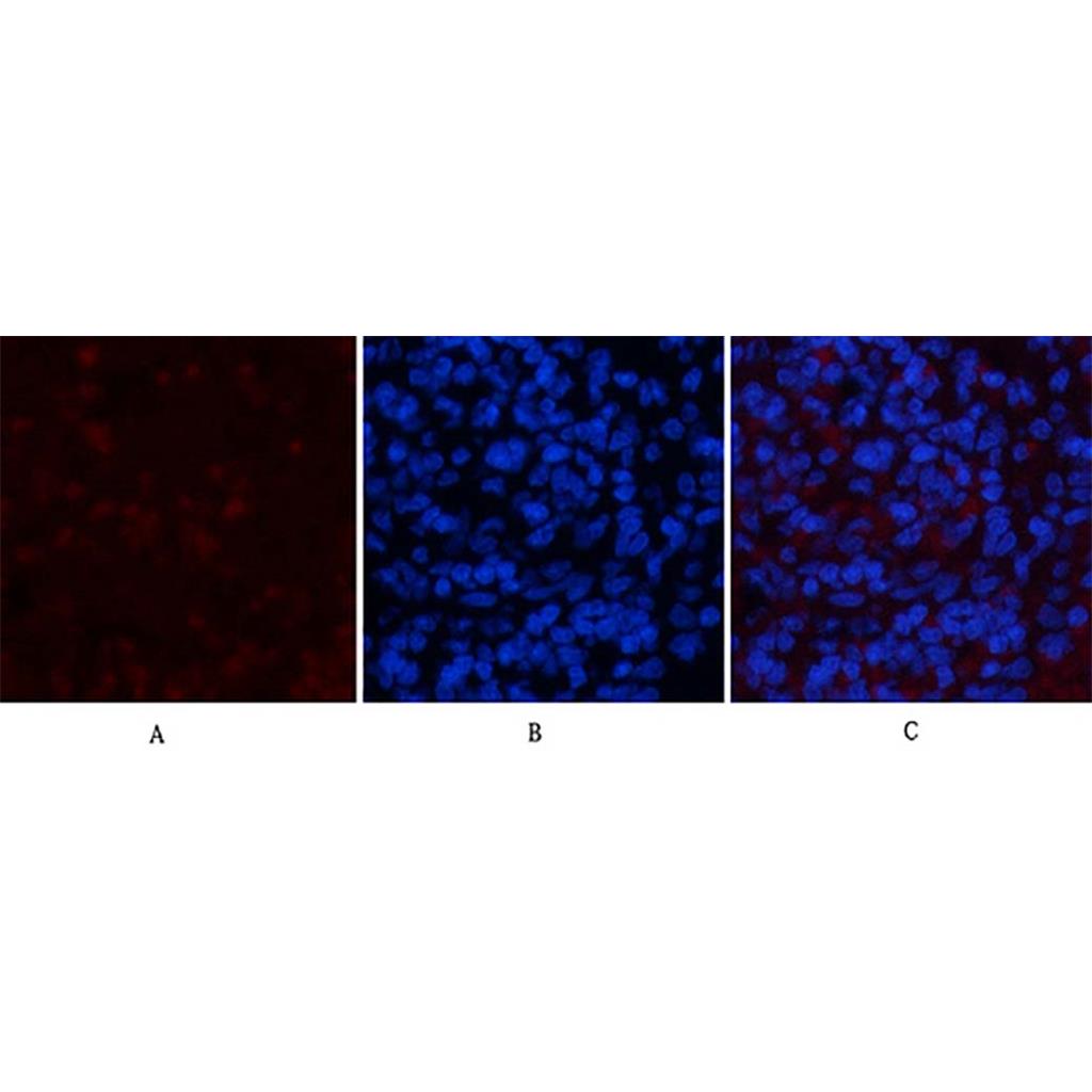 NBR1(7C3)鼠单抗,NBR1(7C3)Mouse Monoclonal Antibody