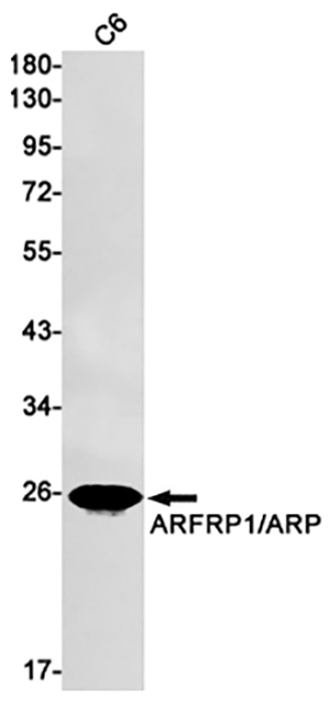 ARFRP1兔单抗,ARFRP1 Rabbit Monoclonal Antibody