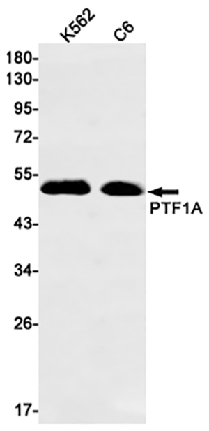 PTF1A兔单抗,PTF1A Rabbit Monoclonal Antibody