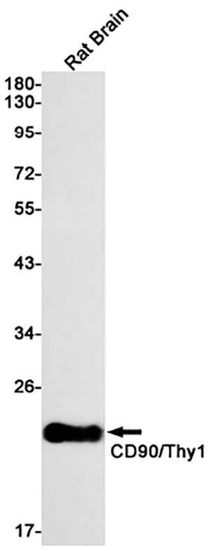 CD90兔单抗,CD90 Rabbit Monoclonal Antibody