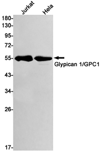 Glypican 1兔单抗,Glypican 1 Rabbit Monoclonal Antibody