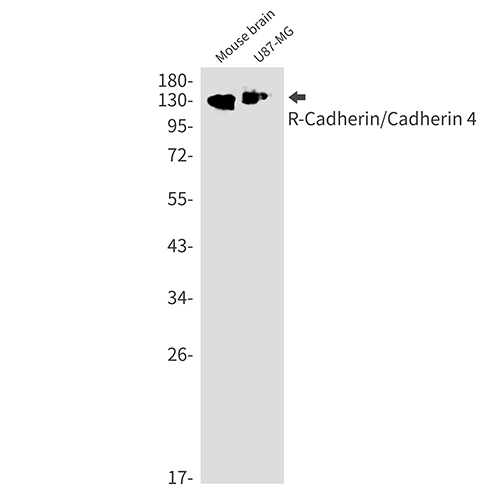R Cadherin兔单抗,R Cadherin Rabbit Monoclonal Antibody