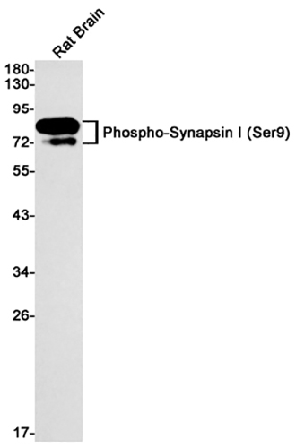 Phospho-Synapsin I (Ser9)兔单抗,Phospho-Synapsin I (Ser9) Rabbit Monoclonal Antibody