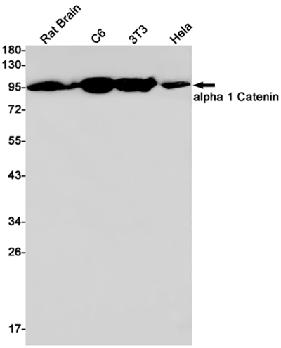 CTNNA1兔单抗,CTNNA1 Rabbit Monoclonal Antibody