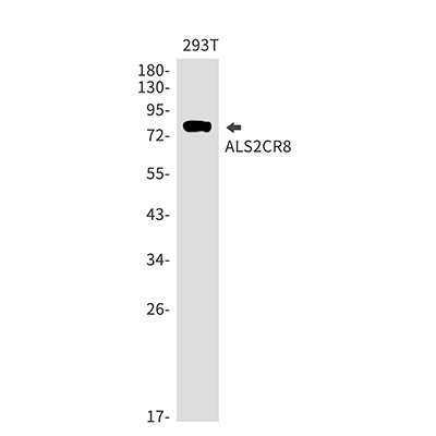 ALS2CR8兔单抗,ALS2CR8 Rabbit Monoclonal Antibody