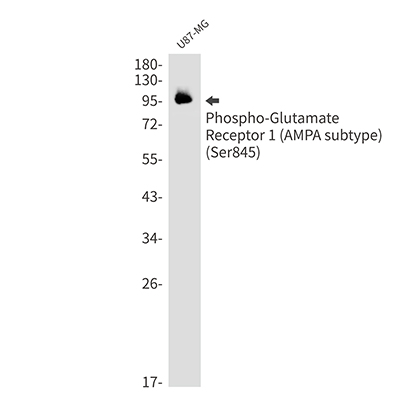 Phospho-Glutamate Receptor 1 (AMPA Subtype) (Ser845)兔单抗,Phospho-Glutamate Receptor 1 (AMPA Subtype) (Ser845) Rabbit Monoclonal Antibody