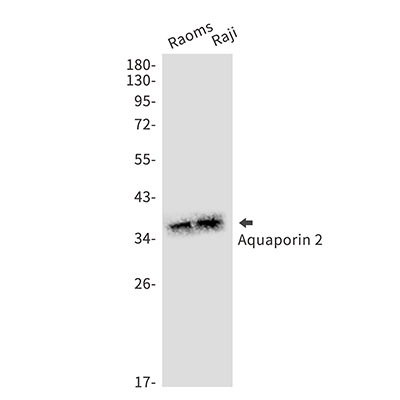 Aquaporin 2兔单抗,Aquaporin 2 Rabbit Monoclonal Antibody