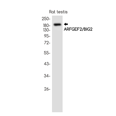 ARFGEF2兔单抗,ARFGEF2 Rabbit Monoclonal Antibody