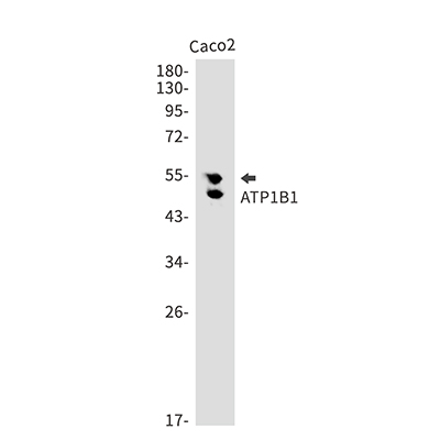 ATP1B1兔单抗,ATP1B1 Rabbit Monoclonal Antibody