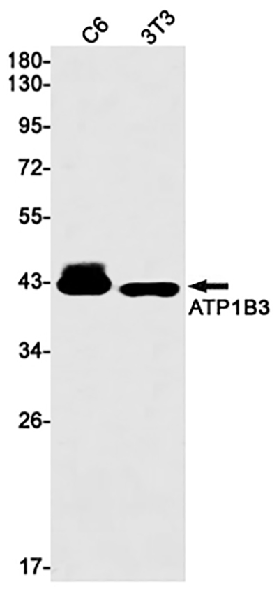 ATP1B3兔单抗,ATP1B3 Rabbit Monoclonal Antibody