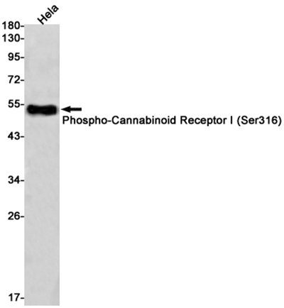 Phospho-Cannabinoid Receptor I (Ser316)兔单抗,Phospho-Cannabinoid Receptor I (Ser316) Rabbit Monoclonal Antibody