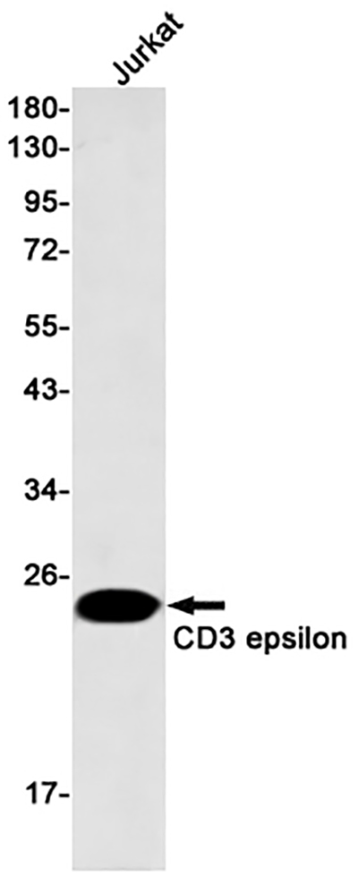 CD3 epsilon兔单抗,CD3 epsilon Rabbit Monoclonal Antibody
