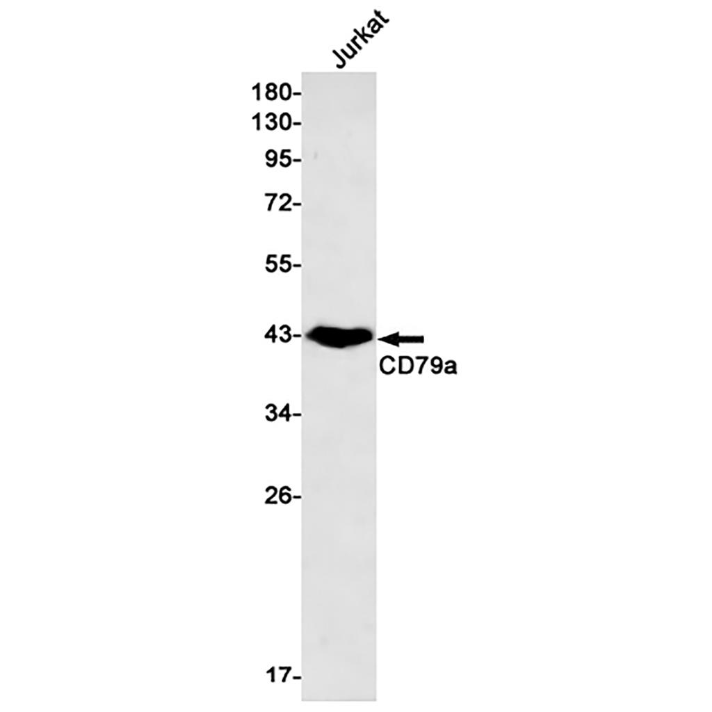 CD79a兔单抗,CD79a Rabbit Monoclonal Antibody