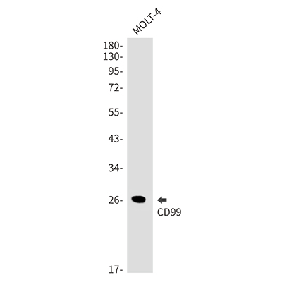 CD99兔单抗,CD99 Rabbit Monoclonal Antibody