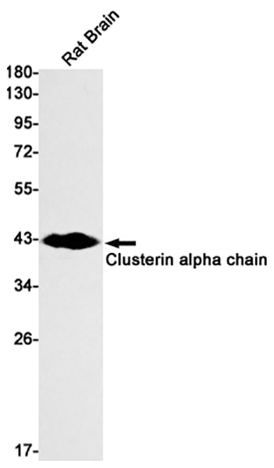 Clusterin alpha Chain兔单抗,Clusterin alpha Chain Rabbit Monoclonal Antibody