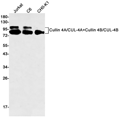 Cullin 4A/4B兔单抗,Cullin 4A/4B Rabbit Monoclonal Antibody