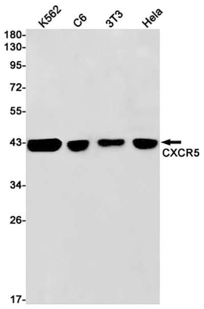 CXCR5兔单抗,CXCR5 Rabbit Monoclonal Antibody