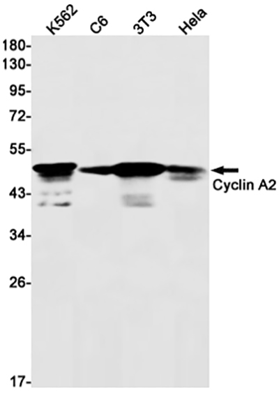 Cyclin A2兔单抗,Cyclin A2 Rabbit Monoclonal Antibody
