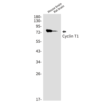 Cyclin T1兔单抗,Cyclin T1 Rabbit Monoclonal Antibody