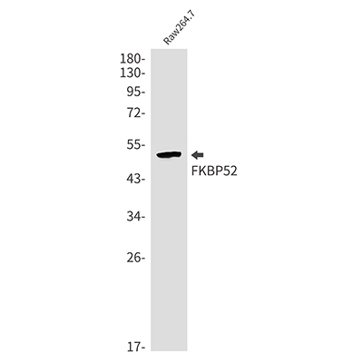FKBP52兔单抗,FKBP52 Rabbit Monoclonal Antibody