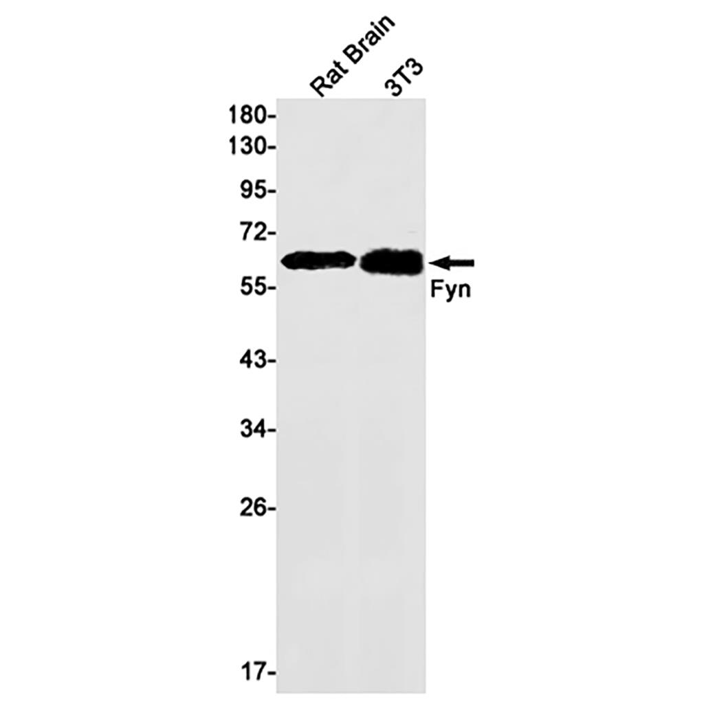 FYN兔单抗,FYN Rabbit Monoclonal Antibody