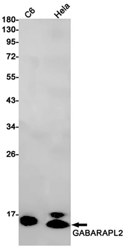 GABARAPL2兔单抗,GABARAPL2 Rabbit Monoclonal Antibody