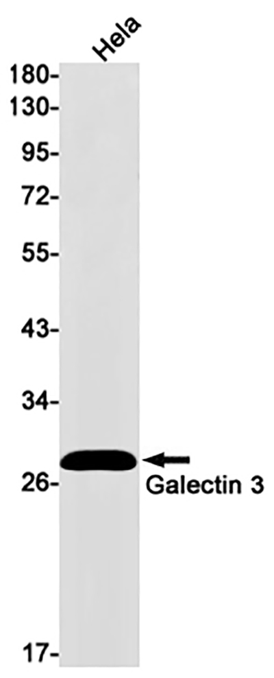 Galectin 3兔单抗,Galectin 3 Rabbit Monoclonal Antibody