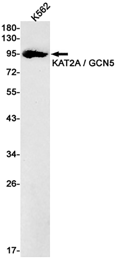 KAT2A兔单抗,KAT2A Rabbit Monoclonal Antibody