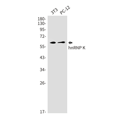 hnRNP K兔单抗,hnRNP K Rabbit Monoclonal Antibody