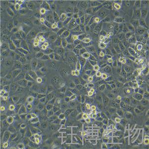 NHEK（正常人表皮角质形成细胞）YB-71765HC