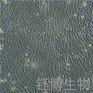 HPASMC（人肺动脉平滑肌细胞）YB-71772HC