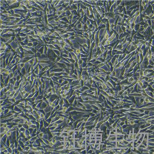 WM115（人黑色素瘤细胞）YB-71774HC,WM115