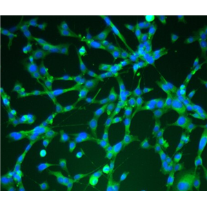 人眼眶成纤维细胞,Human orbital fibroblasts