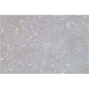 大鼠肝癌细胞CBRH-7919(种属鉴定) | EnkiLife恩玑生命