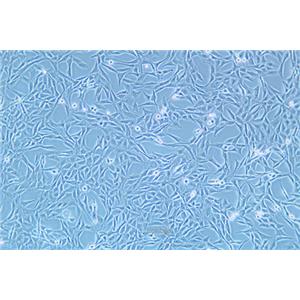 大鼠胶质肉瘤细胞9L/lacZ(种属鉴定) | EnkiLife恩玑生命