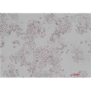 大鼠胰岛β细胞瘤细胞RIN-m5f