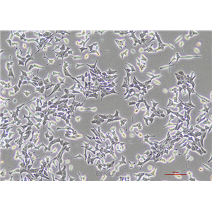 大鼠胰岛细胞瘤细胞INS-1