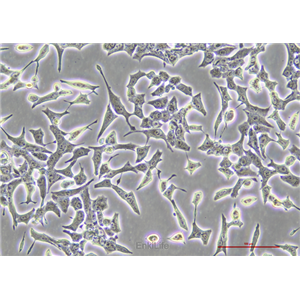 大鼠胰岛细胞瘤细胞INS-1