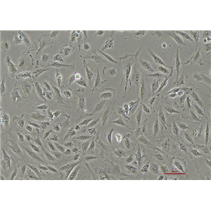 大鼠正常肾成纤维细胞NRK-49F